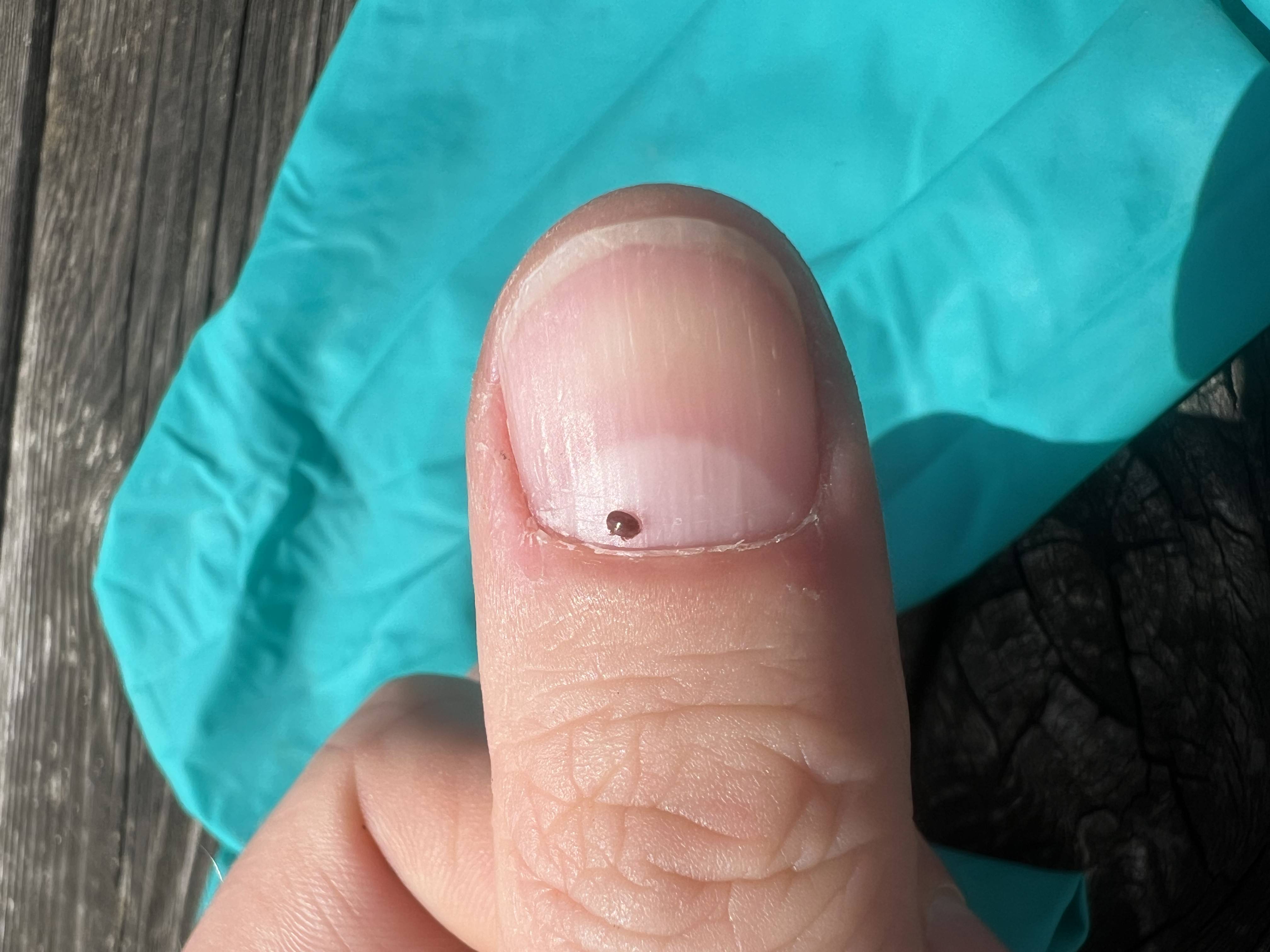 Image of mite on thumb for scale